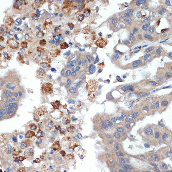 PRSS2 Rabbit monoclonal antibody