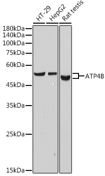 ATP4B Rabbit monoclonal antibody