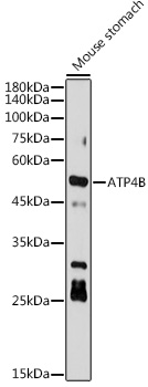 ATP4B Rabbit monoclonal antibody