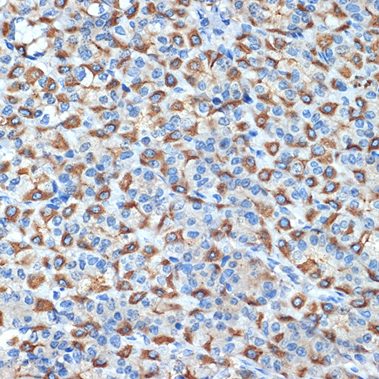ATP4B Rabbit monoclonal antibody
