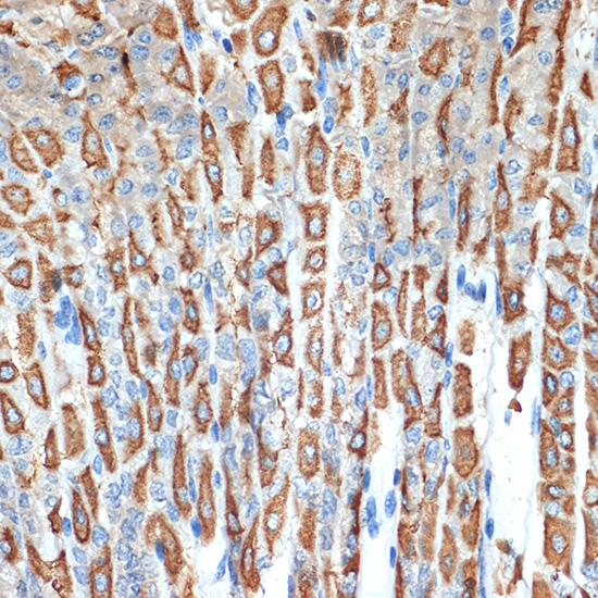 ATP4B Rabbit monoclonal antibody