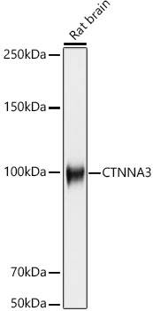 CTNNA3 Rabbit monoclonal antibody