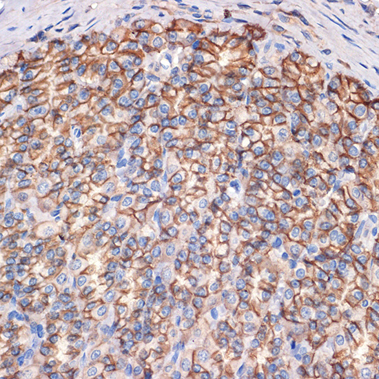 CTNNA3 Rabbit monoclonal antibody
