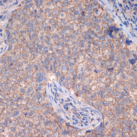 CTNNA3 Rabbit monoclonal antibody