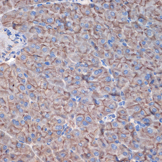 CTNNA3 Rabbit monoclonal antibody