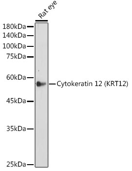 Cytokeratin 12 (KRT12) Rabbit monoclonal antibody
