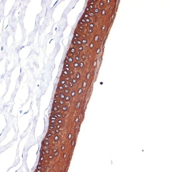 Cytokeratin 12 (KRT12) Rabbit monoclonal antibody