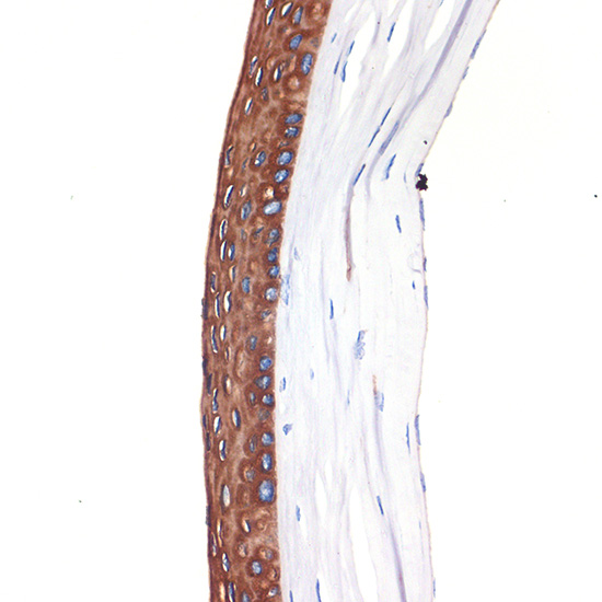 Cytokeratin 12 (KRT12) Rabbit monoclonal antibody