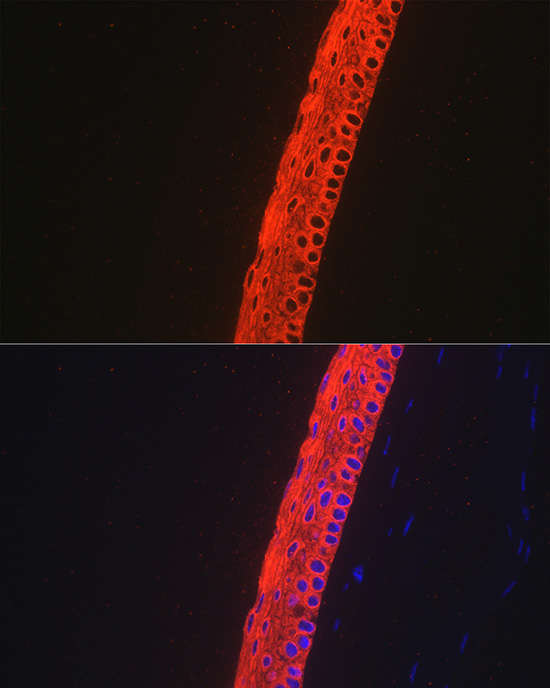 Cytokeratin 12 (KRT12) Rabbit monoclonal antibody