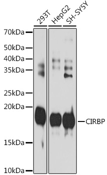 CIRBP Rabbit monoclonal antibody