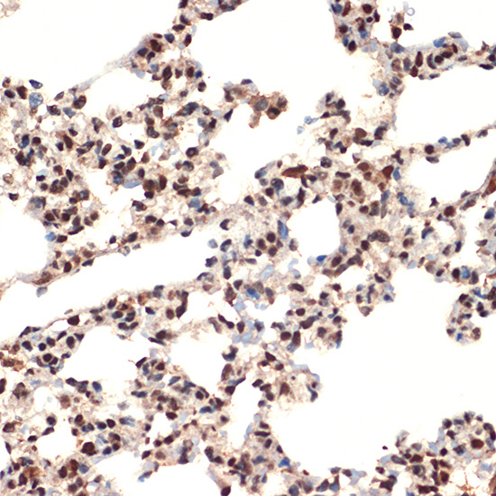 CIRBP Rabbit monoclonal antibody