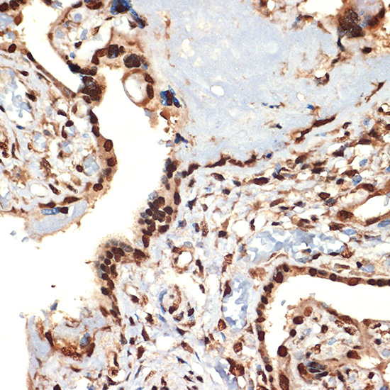 CIRBP Rabbit monoclonal antibody