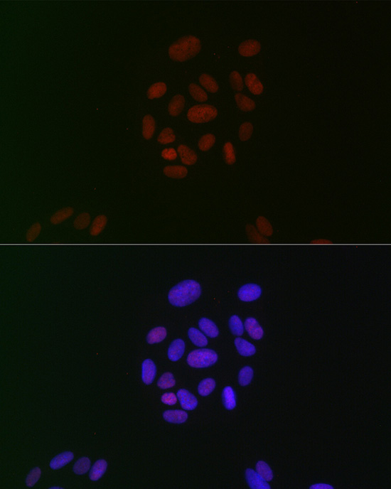 CIRBP Rabbit monoclonal antibody