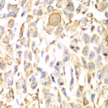 CD151 Rabbit polyclonal antibody