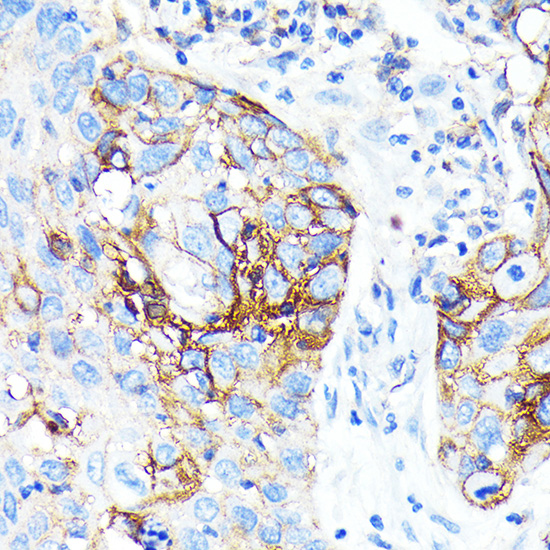 ICAM-1/CD54 Rabbit monoclonal antibody