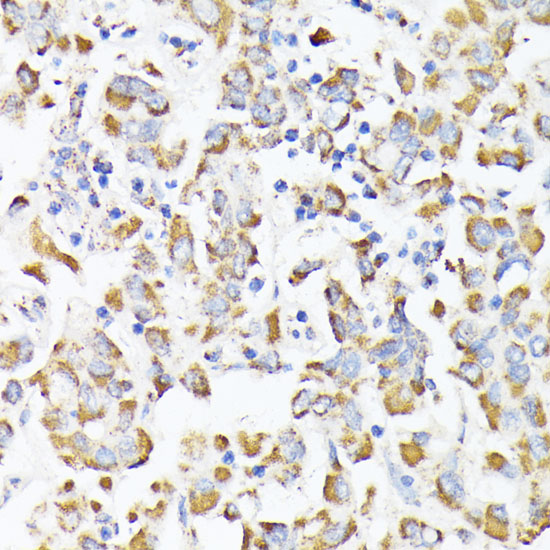 RHOG Rabbit polyclonal antibody