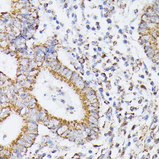 RHOG Rabbit polyclonal antibody