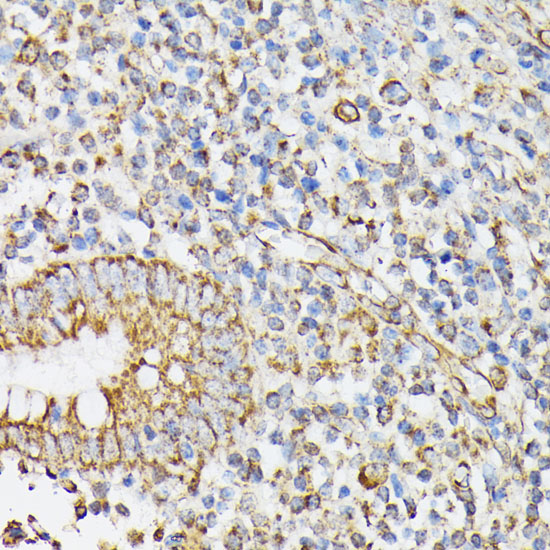 RHOG Rabbit polyclonal antibody