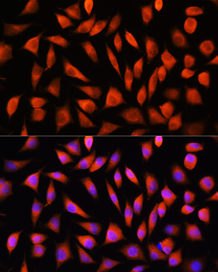 RHOG Rabbit polyclonal antibody