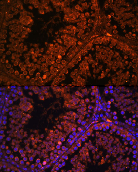 ART3 Rabbit polyclonal antibody