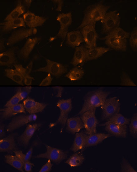 ARVCF Rabbit polyclonal antibody