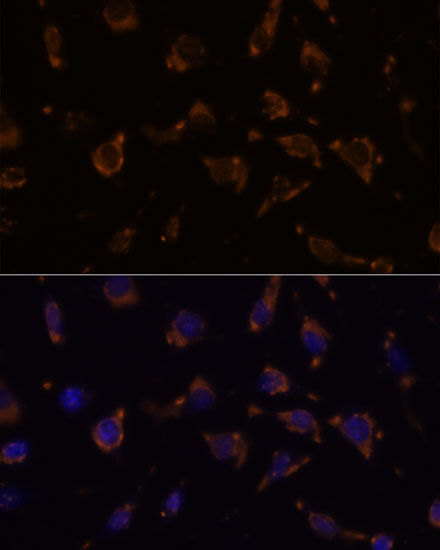 ARVCF Rabbit polyclonal antibody