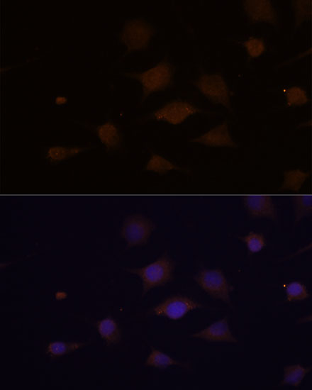 CHML Rabbit polyclonal antibody