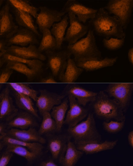 ATN1 Rabbit polyclonal antibody