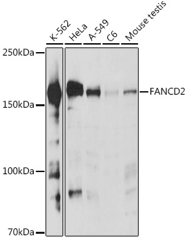 FANCD2 Rabbit polyclonal antibody