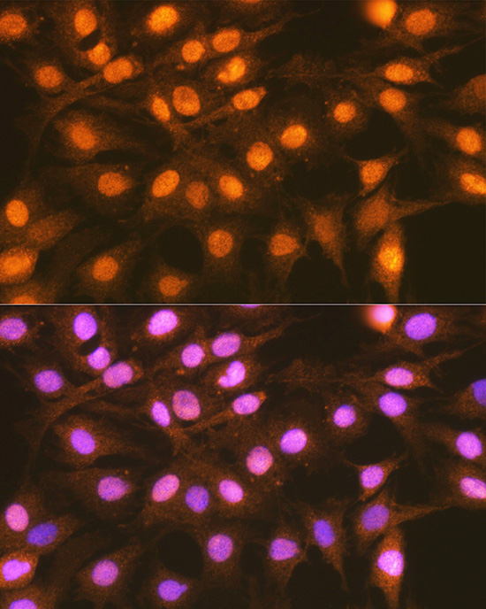 FANCD2 Rabbit polyclonal antibody