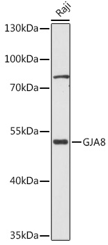 GJA8 Rabbit polyclonal antibody