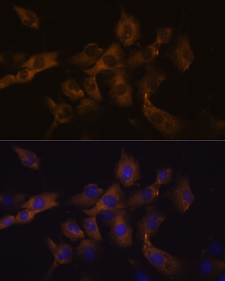 GJA8 Rabbit polyclonal antibody