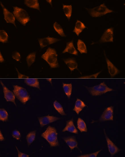 GJA8 Rabbit polyclonal antibody