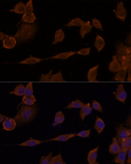 GNA11 Rabbit polyclonal antibody