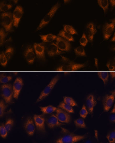 GRID2 Rabbit polyclonal antibody