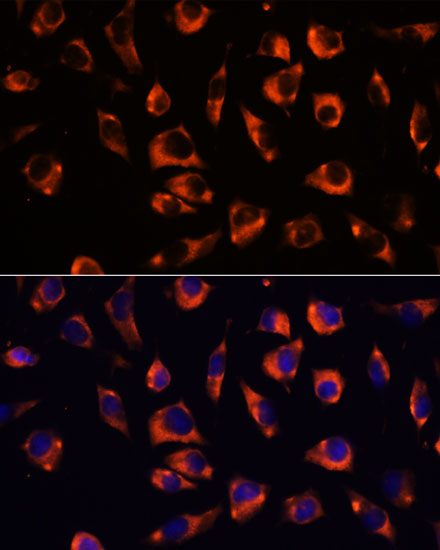 GRID2 Rabbit polyclonal antibody