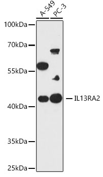 IL13RA2 Rabbit polyclonal antibody
