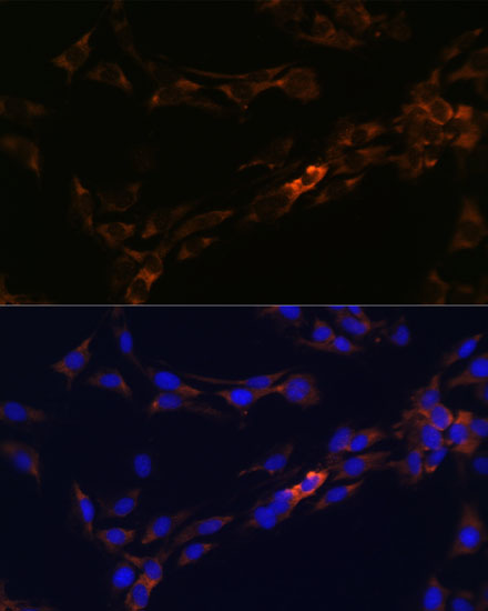 IL13RA2 Rabbit polyclonal antibody