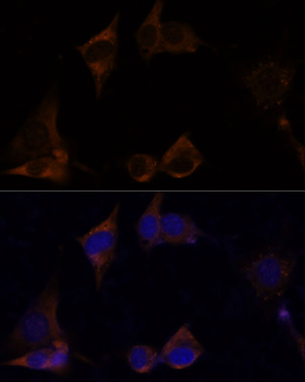 IL13RA2 Rabbit polyclonal antibody