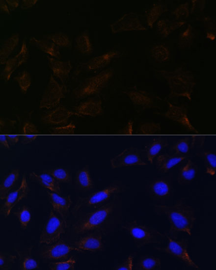 IL13RA2 Rabbit polyclonal antibody