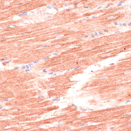 MARK3 Rabbit polyclonal antibody