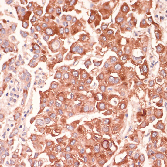 MARK3 Rabbit polyclonal antibody
