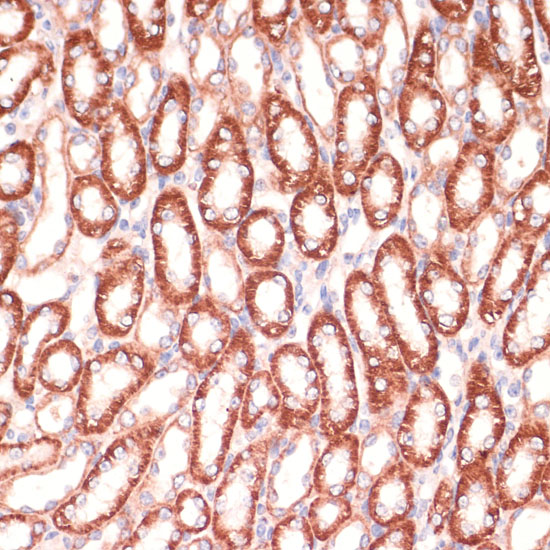 MARK3 Rabbit polyclonal antibody