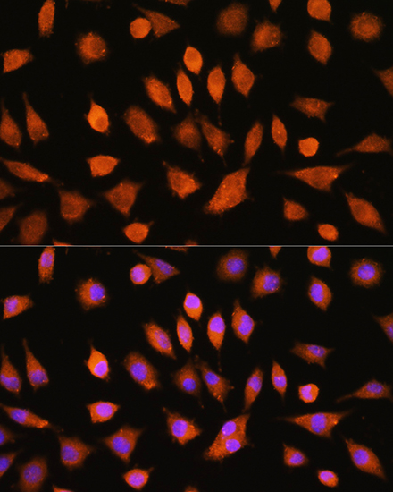 PI4KA Rabbit polyclonal antibody