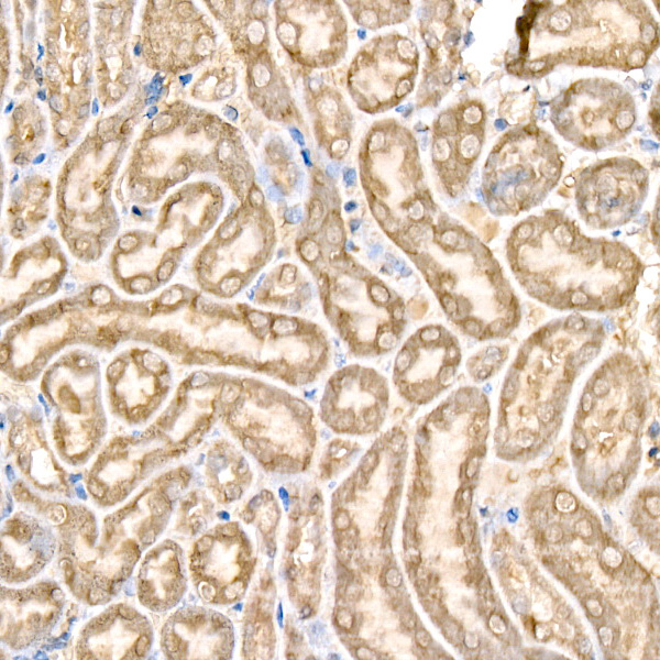 [KD Validated] GPX4 Rabbit polyclonal antibody