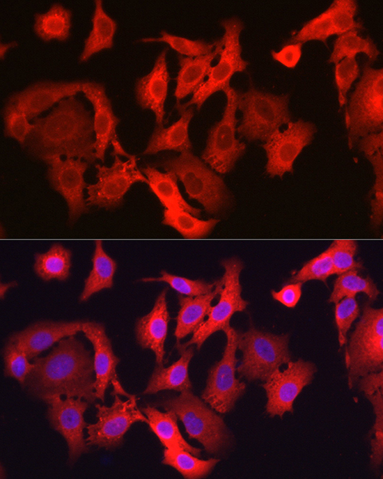 [KD Validated] GPX4 Rabbit polyclonal antibody