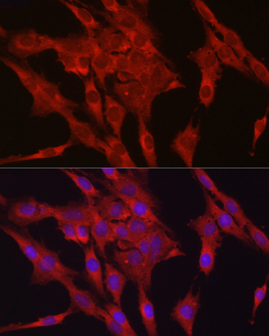 [KD Validated] GPX4 Rabbit polyclonal antibody