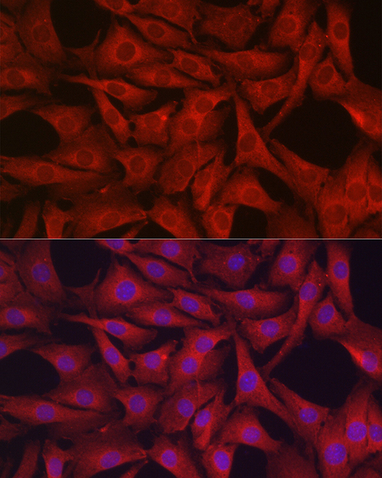 [KD Validated] GPX4 Rabbit polyclonal antibody