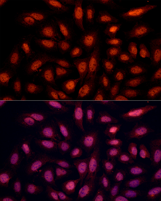 POU4F2 Rabbit polyclonal antibody