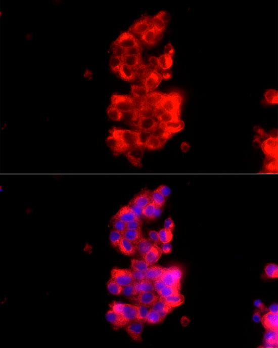 [KD Validated] RAB27A Rabbit polyclonal antibody
